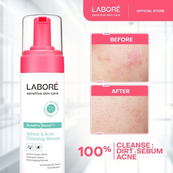 Labore AcnePro Biome Sebum & Acne Cleansing Mousse 150Ml - Sabun Pembersih Wajah Berminyak dan Berjerawat - Gambar 2